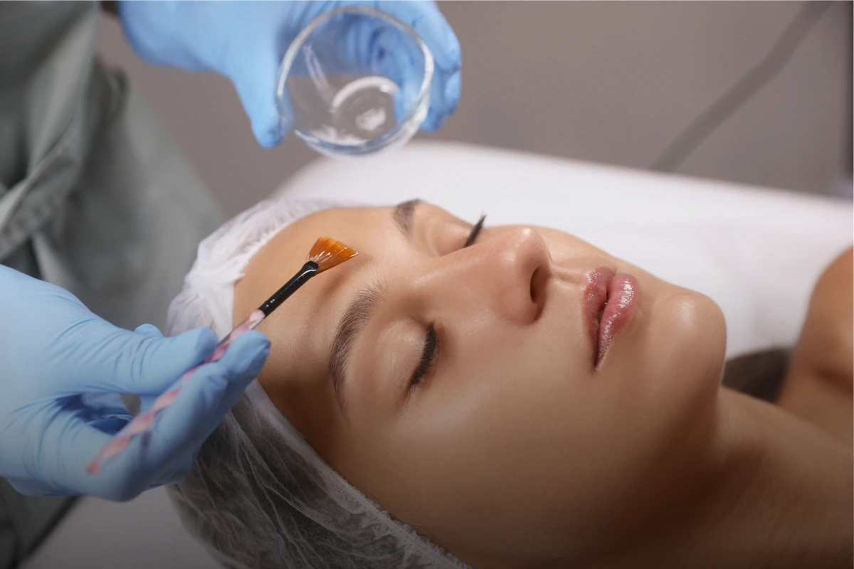 Chemical Peels treatment at Taara Skin and Hair Clinic